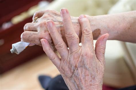 How To Care For Aging Hands