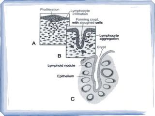 Anatomy and physiology of the palatine tonsil | PPT