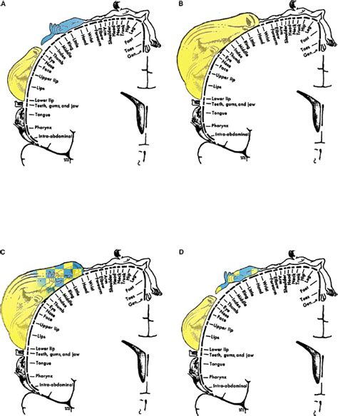 Schematic View Of Topographic Changes In The Somatosensory Cortex Ad