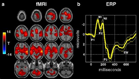 Group Averaged FMRI And ERP Results Group FMRI Left And ERP Right