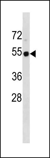 TP53 Antibody Center Affinity Purified Rabbit Polyclonal Antibody