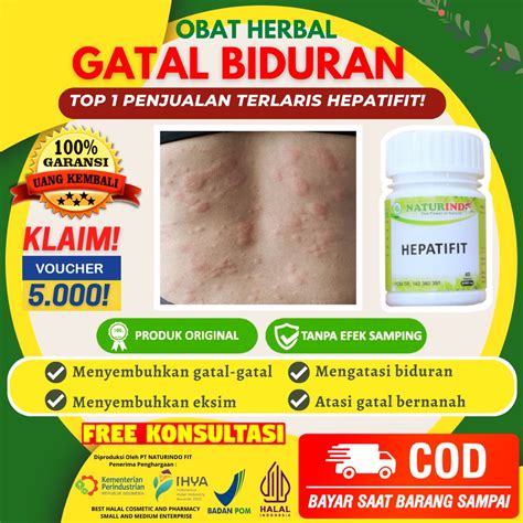 Jual Obat Gatal Biduran Ampuh Gatal Eksim Berair Kering Bentol Alergi