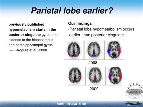 PPT Parietal Lobe Changes Are Important In AD PowerPoint Presentation