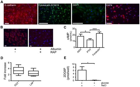 A Expression Of Epithelial Cell Markers E Cadherin Red And