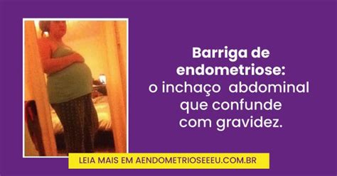 Barriga De Endometriose Antes E Depois - Arquivos Endometriose | Endometriose