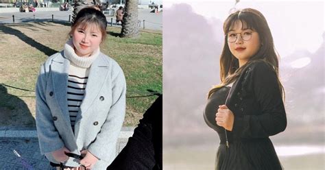 x Hải Dương từng khổ sở vì vòng quá khổ sau phẫu thuật thu nhỏ giờ ra sao Hot trend