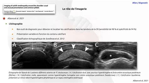 Module La tendinopathie calcifiante de l épaule Diagnostic Bilan