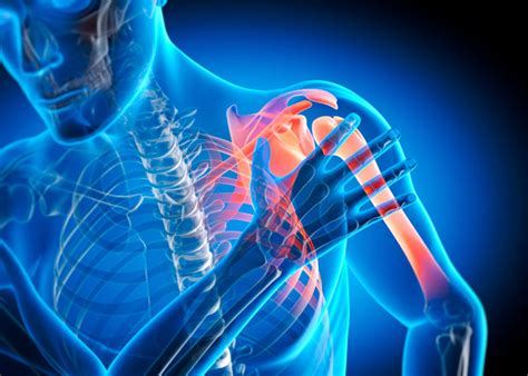 shoulder ortho medisys