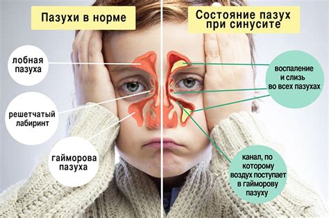 Как лечить «затянувшиеся сопли» у детей. Мифы и реальность