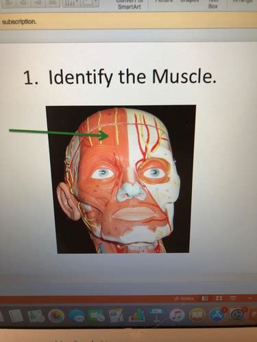 Lab Quiz 6 Flashcards Quizlet