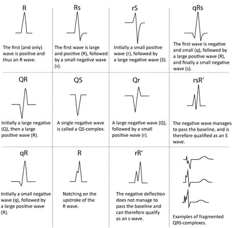 Qrs Complex Various Configuration