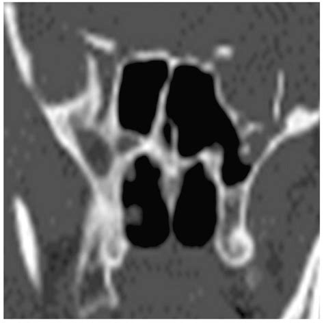 Scielo Brasil Differential Diagnosis And Treatment Of Isolated