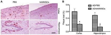 Human Amniotic Membrane Derived Mesenchymal Stem Cell Ammsc Treatment