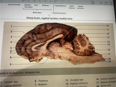 Sheep Brain Labeled Diagram Quizlet