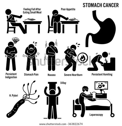 Stomach Cancer Symptoms Causes Risk Factors Stock Vector Royalty Free