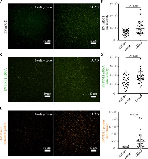 High Throughput Single Ev Liquid Biopsy Rapid Simultaneous And