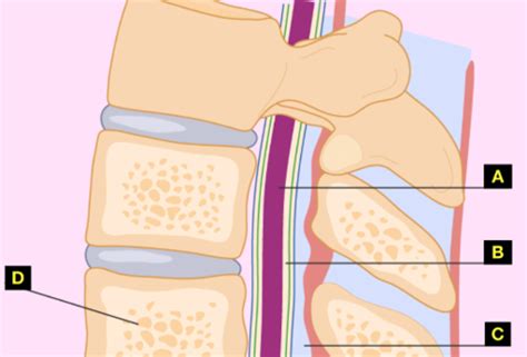 PreLab 6 PCA Epidural Flashcards Quizlet