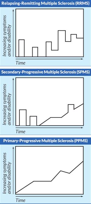 Types of Multiple Sclerosis | MSAA