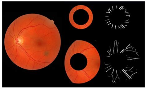 J Imaging Free Full Text Arteriovenous Length Ratio A Novel Method For Evaluating Retinal