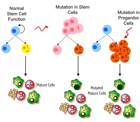 Health Dialys Cancer Stem Cells Used To Treat Cancer