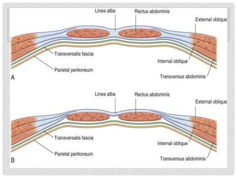 Surgical Anatomy Of Abdomen