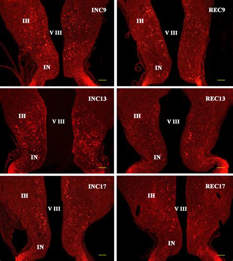 Photomicrographs Illustrating The Distributions Of Vip Ir Neurons And