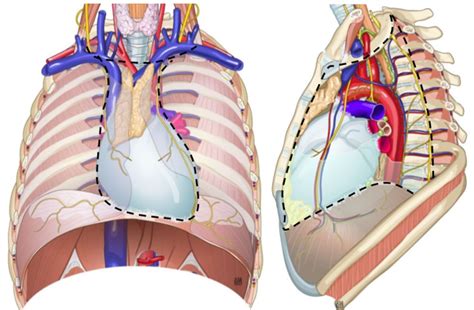 A Schematic Approach To Mediastinal Masses Pdf Download Available