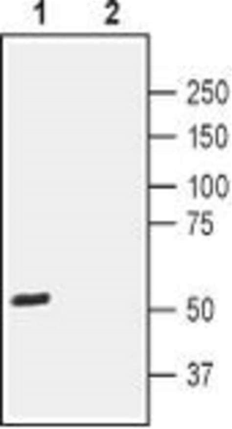 Cd294 Crth2 Extracellular Rabbit Anti Mouse Rat Unconjugated