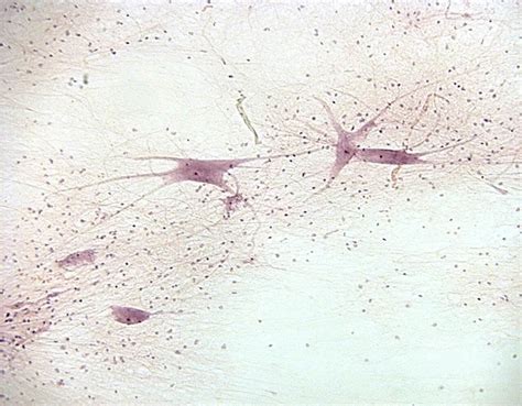 Histology Of Nervous Tissue