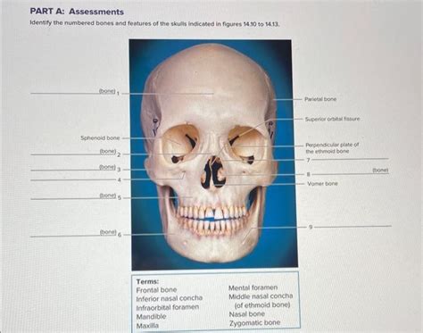 Solved Part A Assessments Identify The Numbered Bones And Chegg