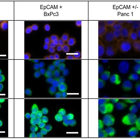 Cytokeratin Expression In Pancreatic Cancer Pancreatic Cancer Cell