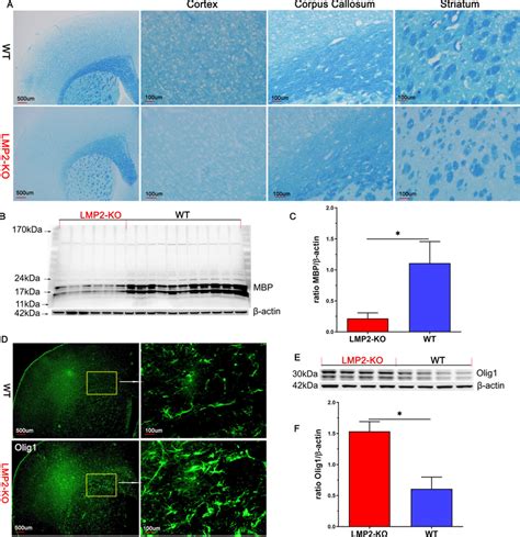 Lmp Gene Deficiency Results In Myelin Loss And Remyelination Coexisted