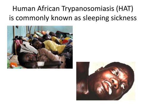 Ppt Human African Trypanosomiasis Powerpoint Presentation Free