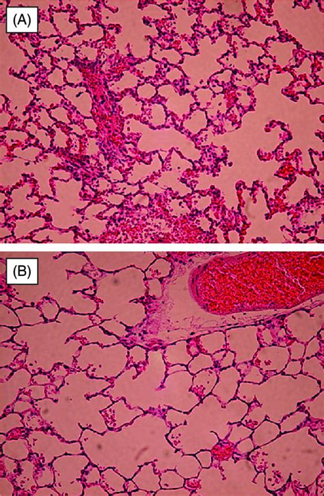 Representative histology of transplanted lungs after 6 h of lung ...
