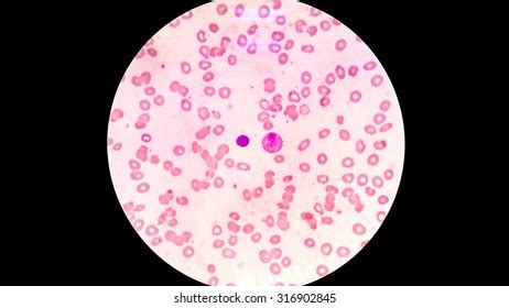 Blood Smear Under Microscope Stock Photo (Edit Now) 316902857