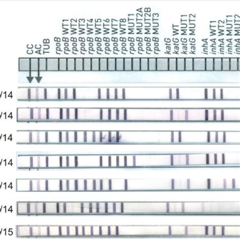 Strips Of Hybridization Patterns Of Rifampicin Resistance In Mtbdrplus