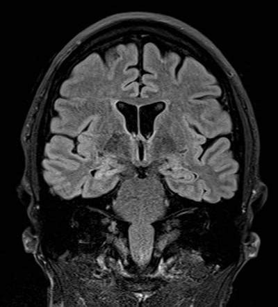 Image Radiopaedia Org