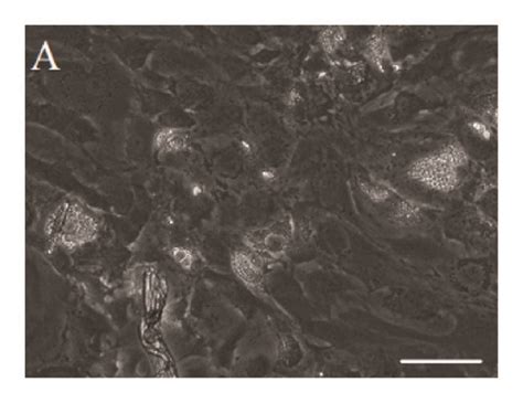 Adipogenic Differentiation Potential Of Third Passage Mscs Cultures