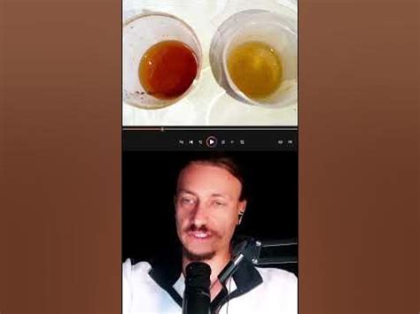 Лактобактерия казей против грибков #грибок #здоровье #кандида # ...