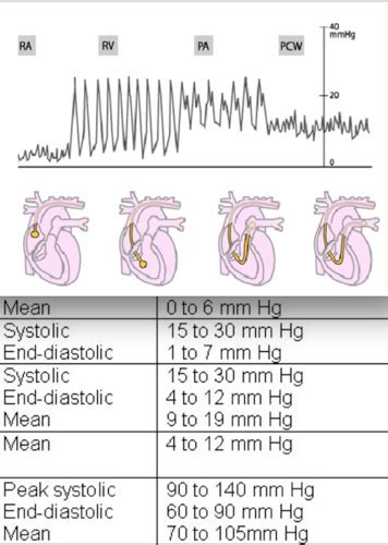 Hemodynamic Monitoring Flashcards Quizlet