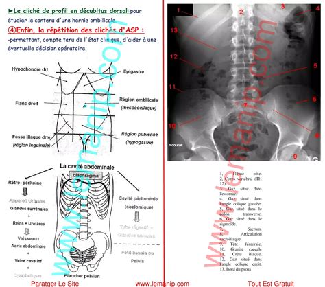 ASP Abdomen Sans Préparation