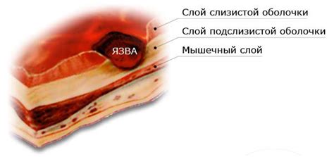 Язва желудка у животных