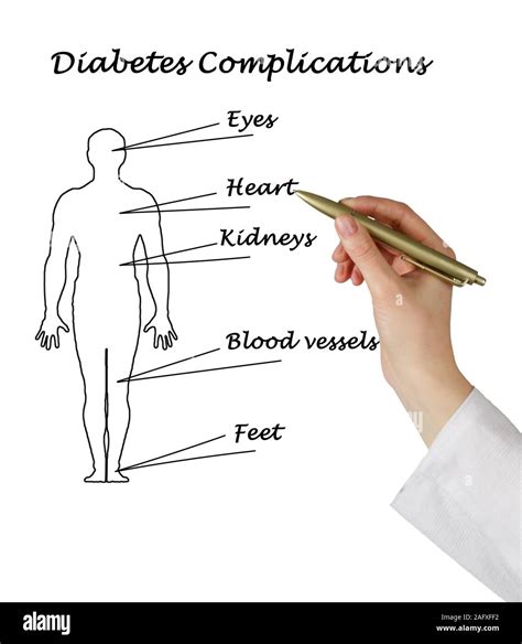 Diabetes Complications Stock Photo Alamy