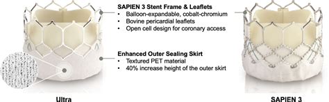 Real World Experience With The Sapien 3 Ultra Transcatheter Heart Valve