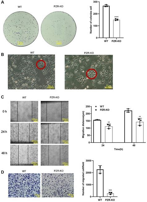 PZR Knockout SPC A1 Cells Exhibit Reduced Proliferative Migrating And