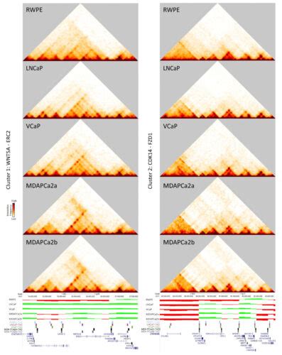 Changes In The D Genome Affect Prostate Cancer Progression Arima