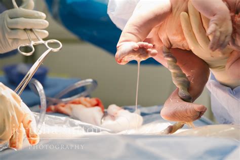 The Caesarean Birth Of Evie Jerusha Sutton Doula Sydney Jerusha