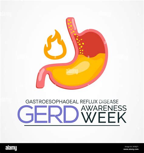 GERD Awareness Week Gastroesophageal Reflux Disease Is Observed Every