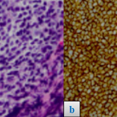 Photomicrograph Original Magnification ×400 A Hematoxylin Eosin Download Scientific