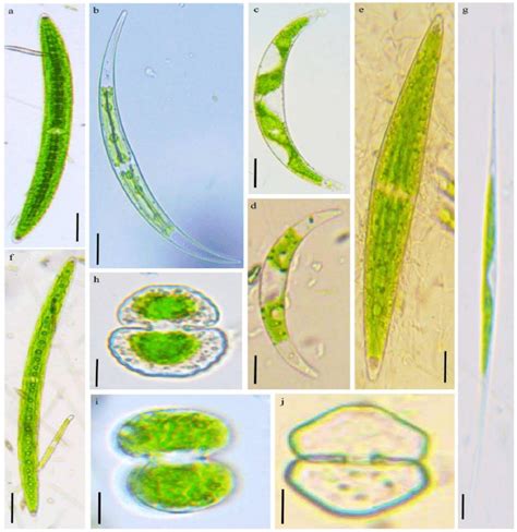 Micro-photograph of identified desmid taxa from study area. (a ...